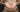 Rueful Stretch Marks! - The Mom Store