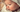 Baby Drool Rash: Causes, Treatment, and Prevention Tips - The Mom Store
