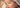 Baby Drool Rash: Causes, Treatment, and Prevention Tips - The Mom Store