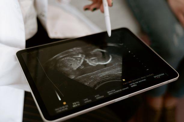 Placenta Previa : All You Need To Know About It - The Mom Store