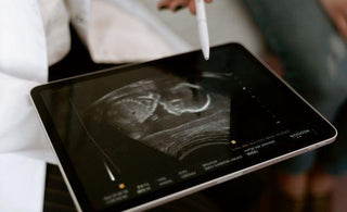 Placenta Previa : All You Need To Know About It - The Mom Store