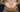 Rueful Stretch Marks! - The Mom Store