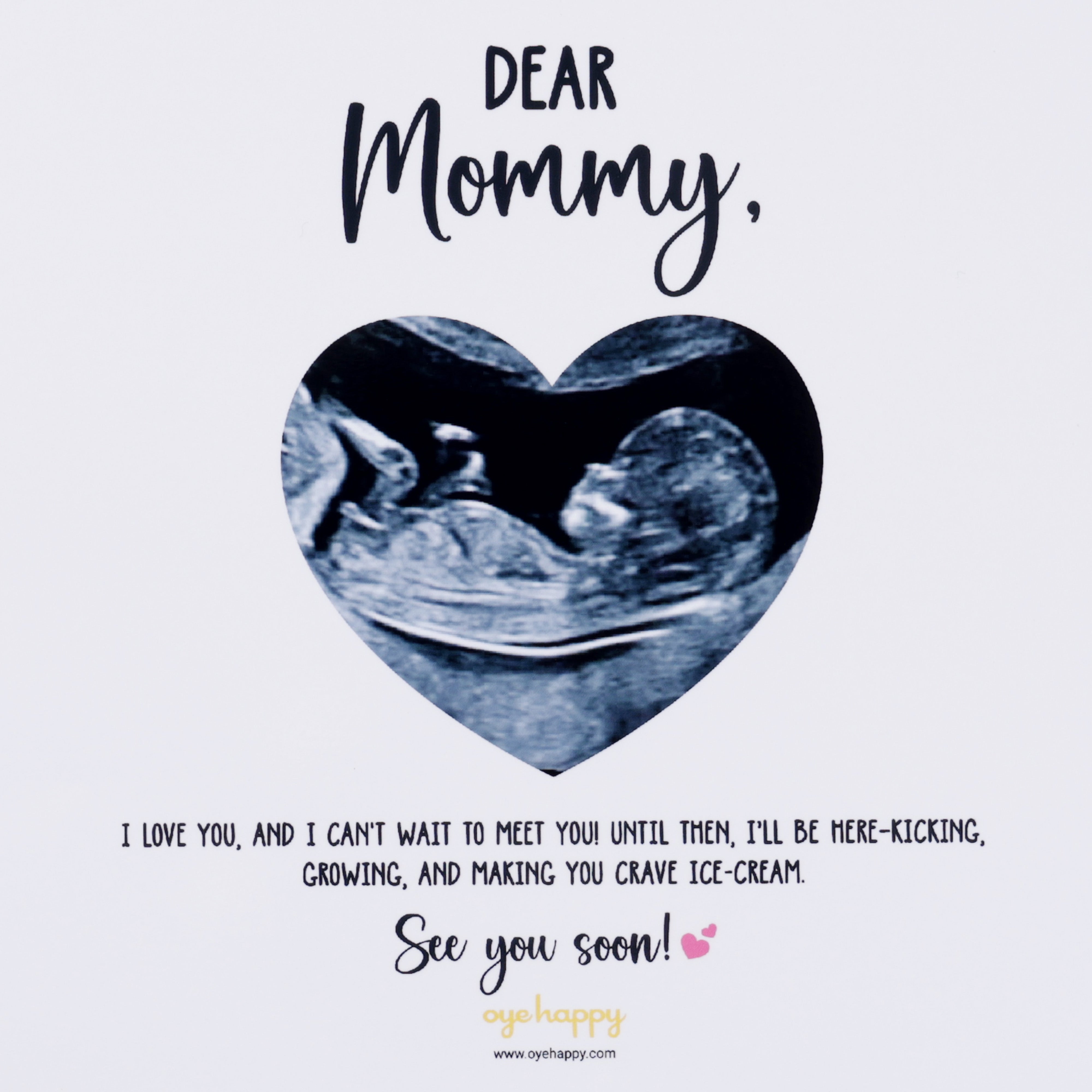 Oye Happy Sonography Frame – A Precious Mother’s Day Gift