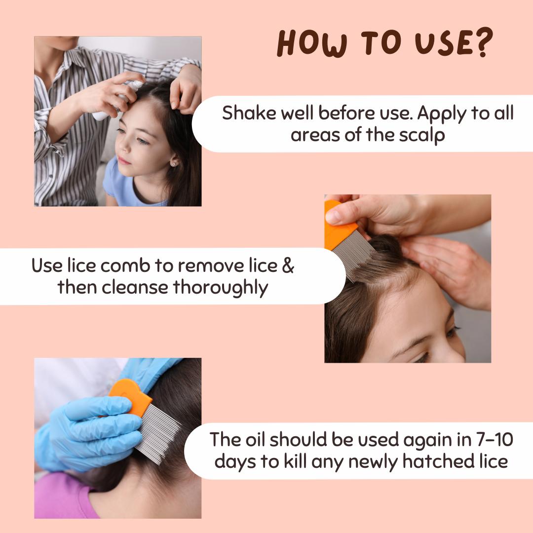 Coco Crush Ayurvedic Anti - Lice Treatment Bundle: Oil, Shampoo & Hair Spray, Kills Lice, Eggs & Nits - pack of 3, 100ML each - LICEOIL100SHAMPOO100SPRAY100