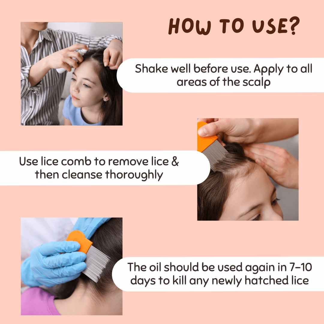 Coco Crush Ayurvedic Lice Remover Hair Oil, 100% Natural - L50