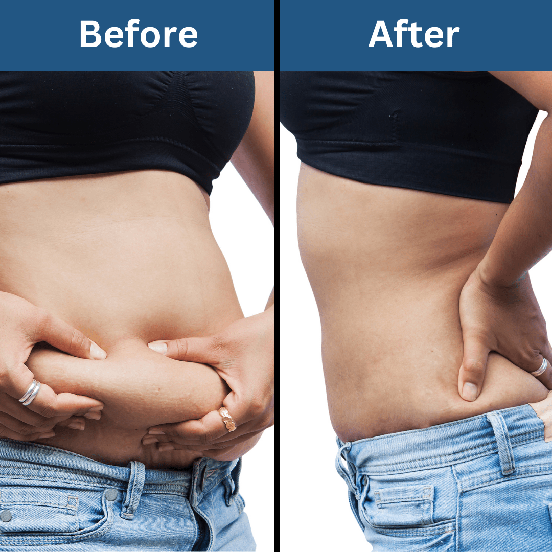Coco Crush Natural Body Toning & Sculpting Massage Oil - Helps in Fat Loss, Anti - Cellulite - SLIMOIL100