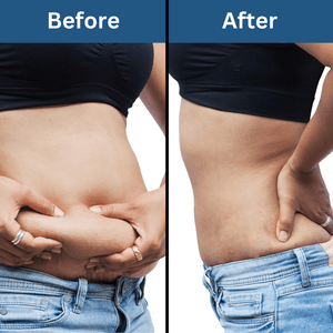 Coco Crush Natural Body Toning & Sculpting Massage Oil - Helps in Fat Loss, Anti - Cellulite - SLIMOIL100
