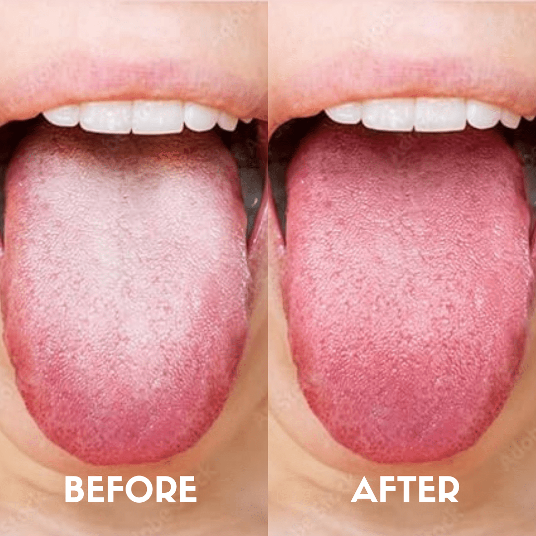 Coco Crush Pure Copper Tongue Cleaner – Natural Breath Freshener & Oral Health Tool - CTC