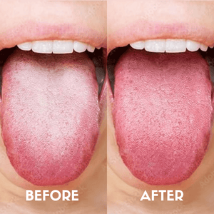 Coco Crush Pure Copper Tongue Cleaner – Natural Breath Freshener & Oral Health Tool - CTC