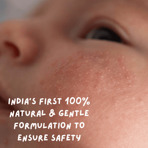 Coco Crush Rash Oil for Babies - Diaper & Nappy Rash Relief - RASHOIL100
