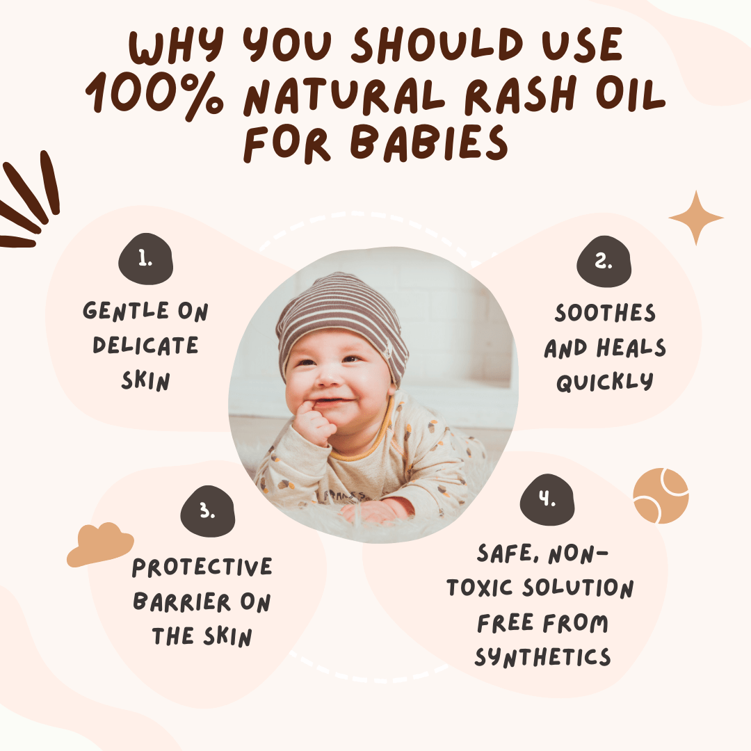 Coco Crush Rash Oil for Babies - Diaper & Nappy Rash Relief - RASHOIL100