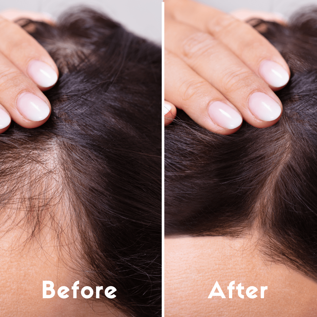Coco Crush Rosemary Lavender Hair Oil - RMLAHO100