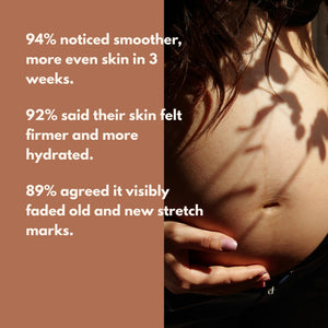 Glo Mama Stretch Mark Roll - On Oil with Centella & Striover - Skincare