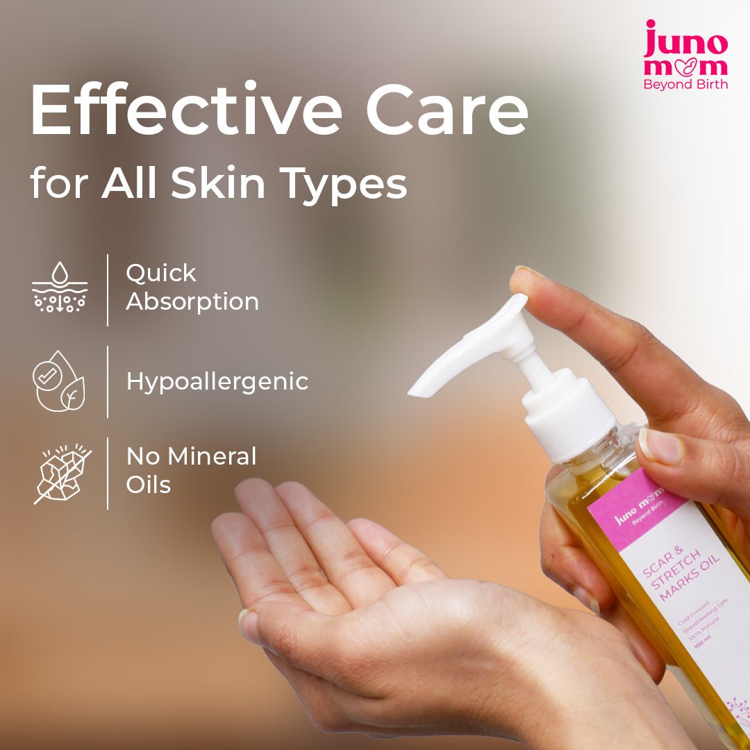 Juno Mom Scar & Stretch Marks Oil | 100ml | Reduces Scars & Stretch Marks - JM_01SO