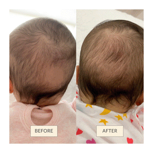 Baby Hair Growth & Scalp Care Oil - OM-22