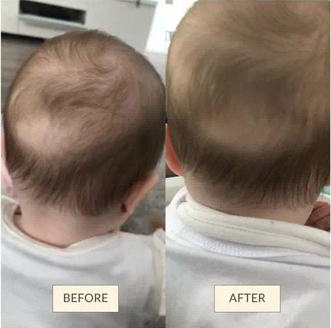 Baby Hair Growth & Scalp Care Oil - OM-22